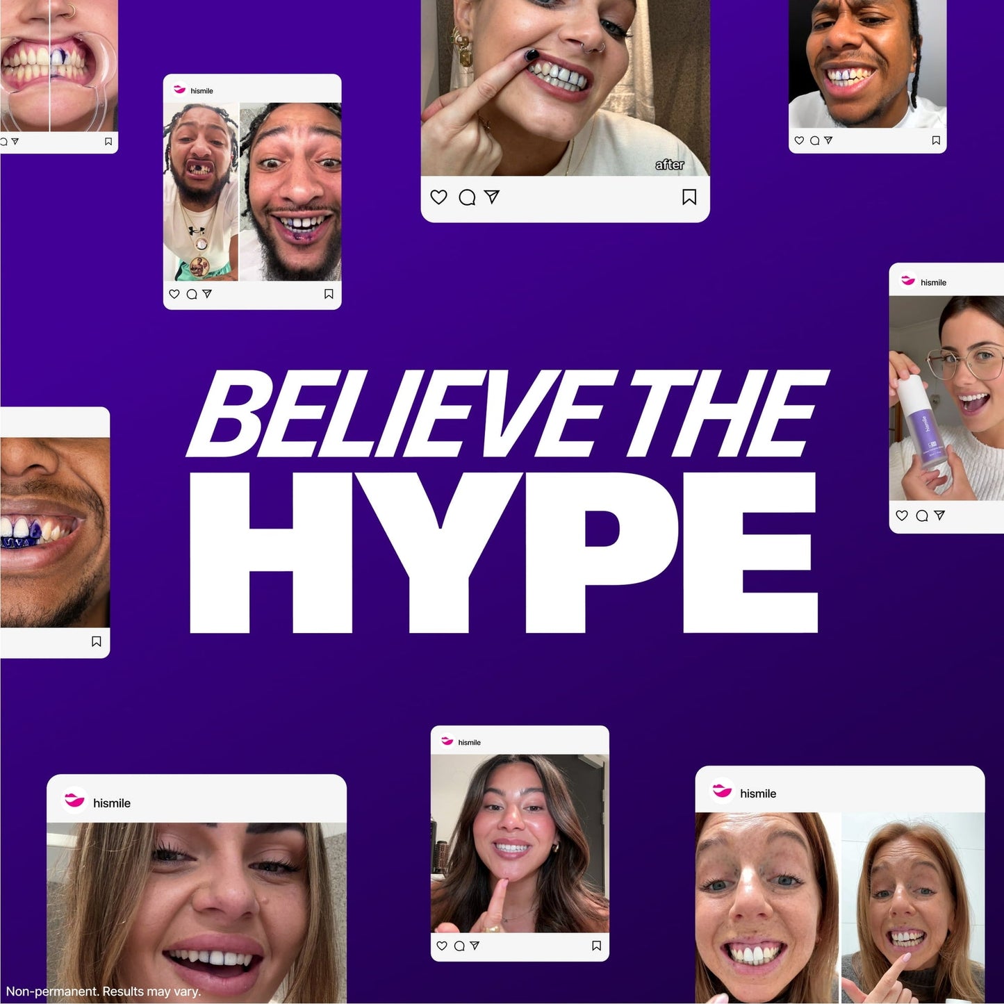 Hi Smile Teeth Whitening Serum V34